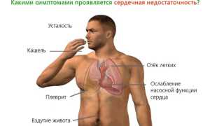 Причины появления сердечного кашля