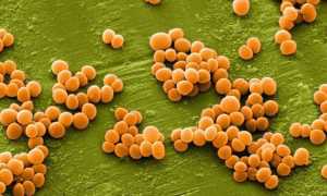 Staphylococcus spp – что это