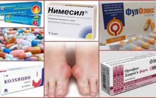 Топ самых эффективных лекарств от подагры — списки препаратов для снятия приступа и выведения мочевой кислоты из организма
