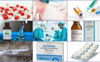 Симптомы и лечение постинъекционного флебита