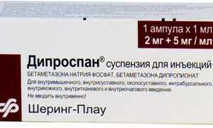 Дипроспан при псориазе