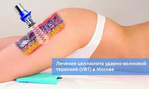 Помогает ли ударно-волновая терапия от целлюлита?