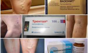 Аналоги Трентала