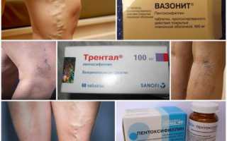 Аналоги Трентала