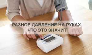 Почему давление на разных руках сильно отличается?