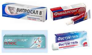 Выбираем самую лучшую мазь при боли в коленном суставе