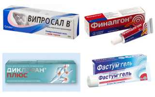 Выбираем самую лучшую мазь при боли в коленном суставе