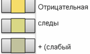 Лейкоцитарная эстераза — первый симптом воспаления мочевыделительной системы