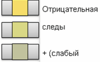Лейкоцитарная эстераза — первый симптом воспаления мочевыделительной системы