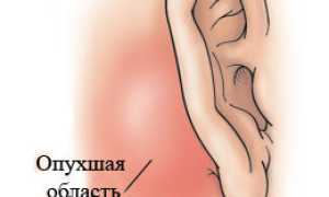 Шишки за ухом: почему появляются, факторы развития, варианты и локализации