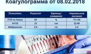 Как называется анализ крови на тромбы при тромбозе и тромбофлебите?