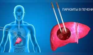 Паразиты в печени человека