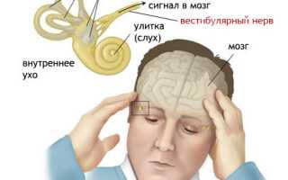 Вестибулопатия: как возникает, формы, проявления, диагностика, как лечить