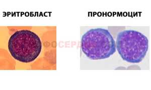 Откуда берутся нормобласты в общем анализе крови?