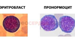 Откуда берутся нормобласты в общем анализе крови?