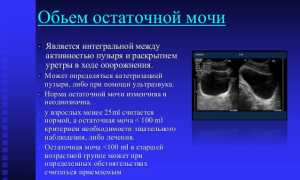 Остаток мочи в мочевом пузыре: норма, определение, лечение