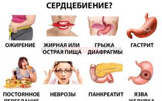 Чем может быть вызвана тахикардия после еды?