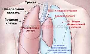 Почему при вдохе колит в области сердца и что делать?