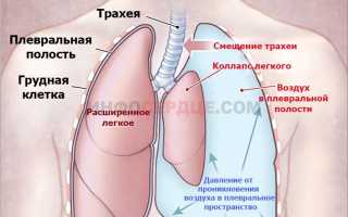 Почему при вдохе колит в области сердца и что делать?