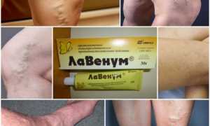 Гель Лавенум для здоровья вен
