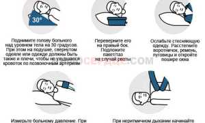Признаки предынсультного состояния