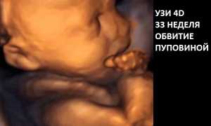 Расшифровка УЗИ на 33-й неделе беременности: размеры плода, вес и другие значимые показатели