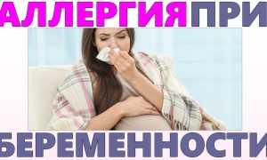 Аллергия при беременности