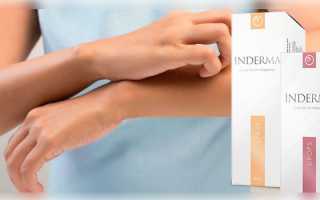 Inderma от псориаза