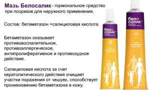 Белосалик при псориазе — лосьон, мазь, крем, отзывы, цены, аналоги