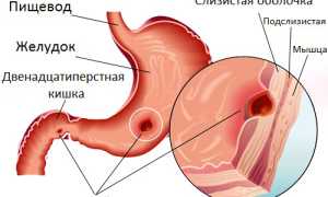 Черный налет на языке: виды, причины, диагностика