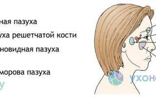 Киста в носовой пазухе: причины и развитие, признаки и течение, диагностика, как лечить
