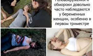 Обмороки при беременности