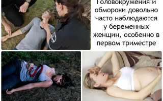 Обмороки при беременности