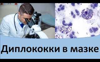 Диплококки в мазке у ребенка