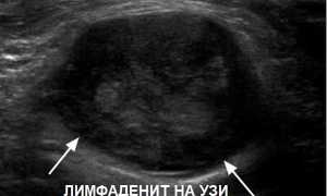 УЗИ лимфатических узлов шеи: какие опасные болезни показывает, показания и противопоказания