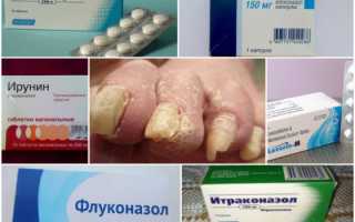 Лучшие противогрибковые таблетки для ногтей