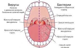 Боль в носоглотке: этиология, болезни и симптоматика, лечение