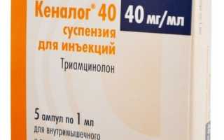 Кеналог — отзывы, цена, аналоги, форма выпуска