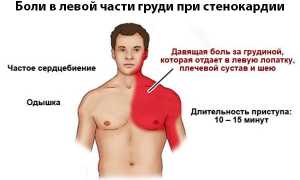 Что такое кардиалгия?