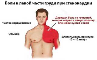 Что такое кардиалгия?