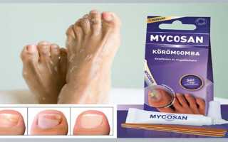 Микозан