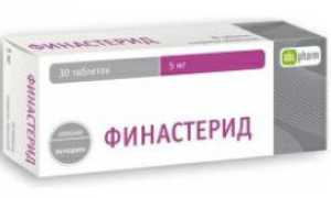 Отзывы мужчин о препарате Финастерид
