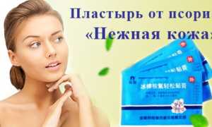 Пластырь от псориаза «Нежная кожа»