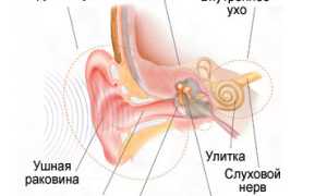 Нарушения слуха: причины, формы, признаки, диагностика, лечение, профилактика