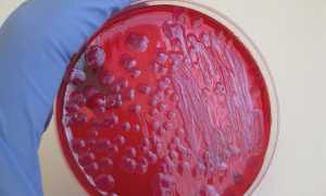 Klebsiella oxytoca в сперме