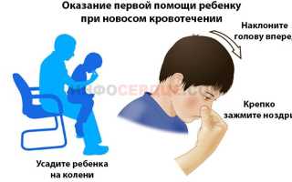 Идет кровь из носа у ребенка: обзор причин, что делать?