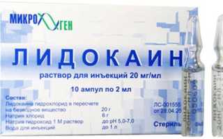 Причины и лечение аллергии на лидокаин