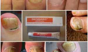 Мазь Экодакс от грибка