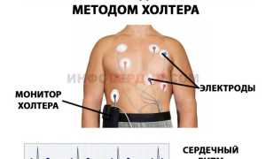 Как вовремя распознать микроинфаркт и что дальше делать?