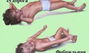 Фебрильные судороги у детей — что это такое, как лечить?